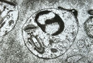 M,28y. | Leishmania - skin M,28y. | Leishmania - skin